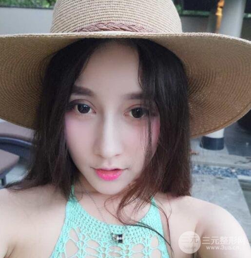 深圳源美做隆鼻失敗修復價格案例