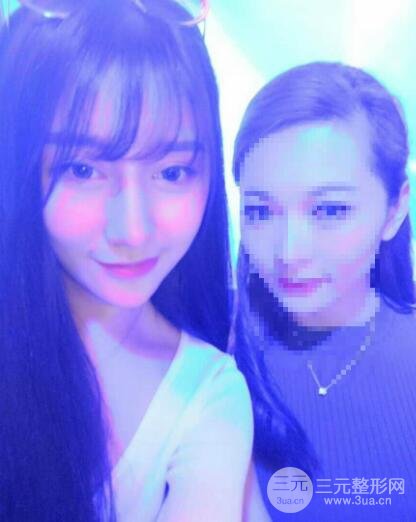 深圳源美做隆鼻失敗修復價格案例