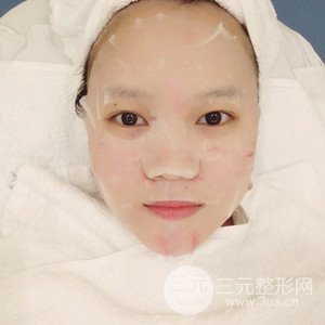 注射水光補(bǔ)水案例——襄陽(yáng)維多利亞聶立敏醫(yī)生做的