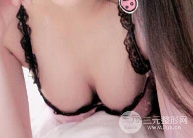 本人自體抽脂隆胸手術(shù)果很好價(jià)格案例