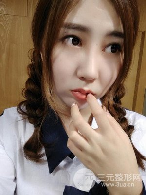 隆鼻整形案例日記分享：附上前后對比圖片