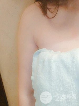 武漢天申朱天申醫(yī)生做的水動力吸脂瘦手臂，真實案例并附上前后對比圖