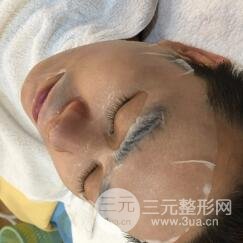 男士高強(qiáng)度聚焦超聲面b提升微整形真實(shí)案例