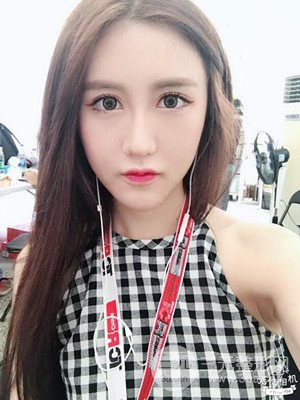 武漢一美汪國民醫(yī)生做的面部吸脂【案例】，分享一下前后對比圖片