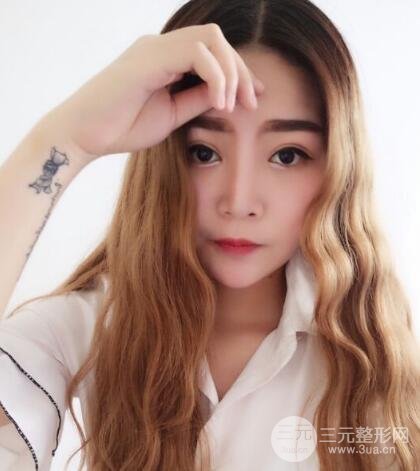 全切開雙眼皮價(jià)格和恢復(fù)過程對比圖片