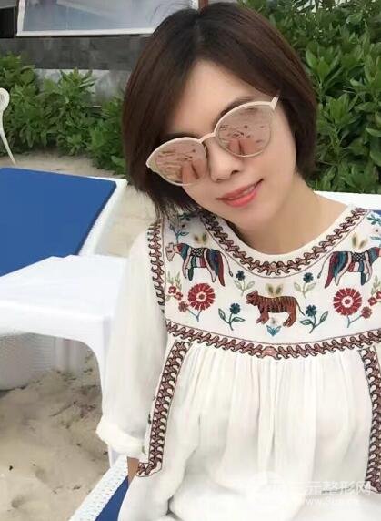 去做了埋線面b提拉術(shù)果很是不錯