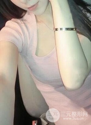 武漢繹君毛林醫(yī)生給我做的假體隆胸手術(shù)，分享一下前后對比圖