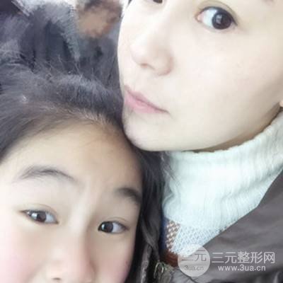 武漢美侖陳遠(yuǎn)海自體脂肪填充全臉案例，附上前后對(duì)比圖片