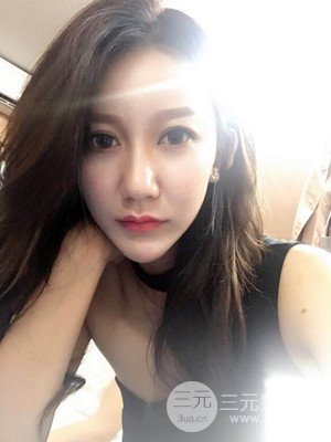 上海原辰自體脂肪填充案例，附上恢復(fù)過程以及對比圖片