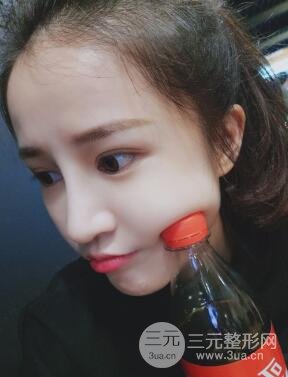 柏麗李勁良假體隆鼻案例果分享！小巧精致又立體~