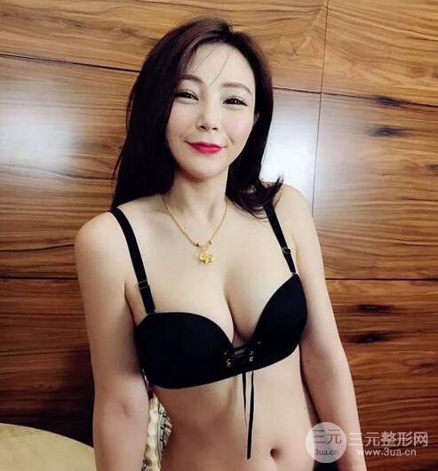 自體脂肪豐胸3個(gè)月分享，活細(xì)胞豐胸術(shù)后果逼真更自然