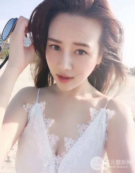 【高強(qiáng)度聚焦超聲面b提升術(shù)后照片】原來(lái)我的青春并沒(méi)有走遠(yuǎn)~