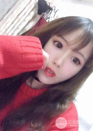 自體脂肪填充全臉基本換臉，改臉型不只是磨骨才能做到！