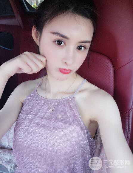 【隆鼻失敗修復(fù)】自體脂肪隆鼻隆鼻整形拯救之后可以隨意揉捏！