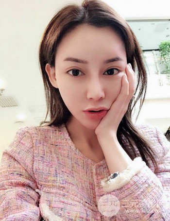 上海隆鼻失敗手術(shù)修復(fù)果超乎想象、前后對比照片分享