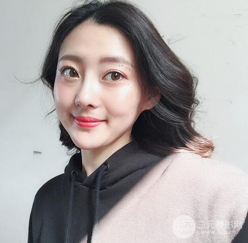 【肋軟骨隆鼻+歪鼻矯正案例】降低風險無排異，可隨意揉捏