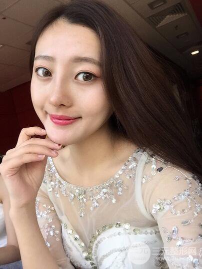 【肋軟骨隆鼻+歪鼻矯正案例】降低風險無排異，可隨意揉捏