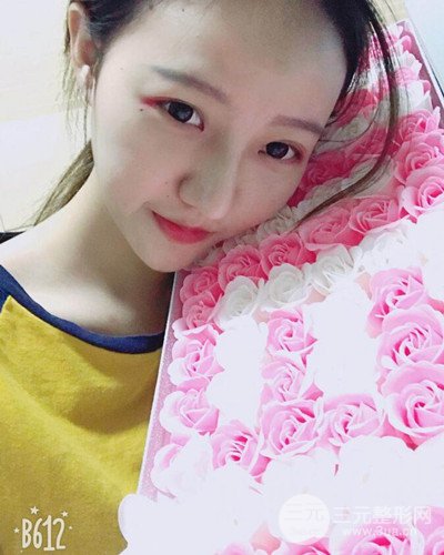 武漢美侖陳遠(yuǎn)海假體隆鼻案例，恢復(fù)過(guò)程分享~