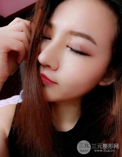 耳軟骨隆鼻全過(guò)程及術(shù)后果分享，親身體驗(yàn)~