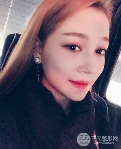 【下頜角+顴骨+下巴】全臉磨骨整形，術(shù)后的我人生開掛了！