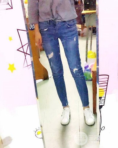 廣州韓妃大腿吸脂案例，恢復(fù)過程前后對比圖片分享~