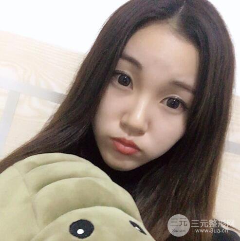 下頜角磨骨整形全過程分享，附上術(shù)后恢復(fù)照片~