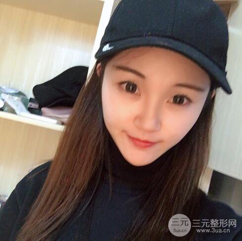 下頜角磨骨整形全過程分享，附上術(shù)后恢復(fù)照片~