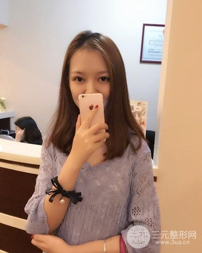 深圳蒳美邇黃海彬雙眼皮案例恢復過程對比圖分享~