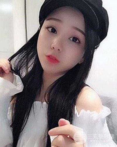 深圳蒳美邇朱燦醫(yī)生眼隆鼻整形案例分享，附上前后對比照~