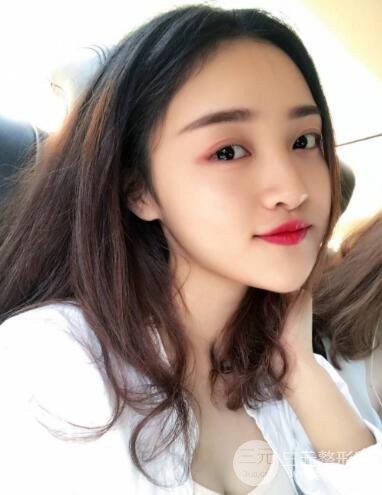 九院曹衛(wèi)剛自體脂肪面部填充案例