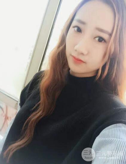 西安西美張麗雙眼皮案例圖片分享