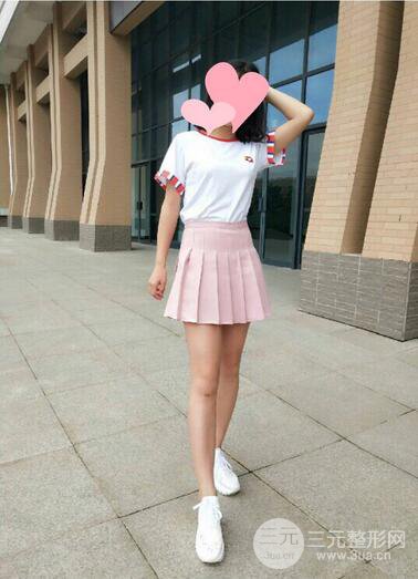 曹衛(wèi)剛大腿吸脂案例恢復(fù)圖片記錄分享