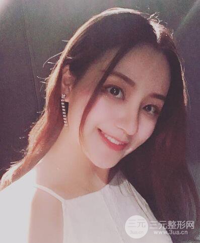 顧陸健做鼻子隆鼻案例術(shù)后恢復(fù)果分享