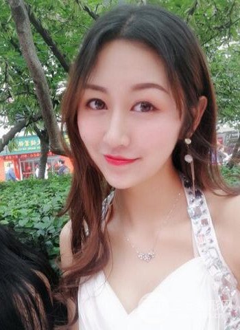 廣州隆鼻整形真實(shí)恢復(fù)期圖片，擁有精致美鼻不是夢(mèng)