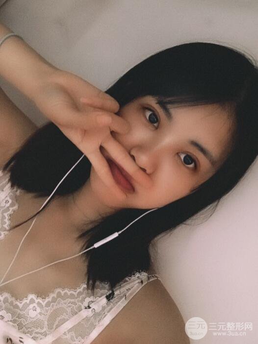 北京禾美嘉任學(xué)會自體脂肪面部填充案例分享