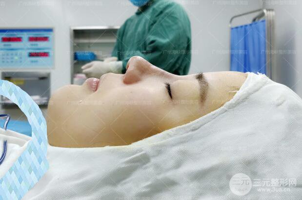 廣州海峽軍隆鼻失敗修復(fù)案例術(shù)后記錄