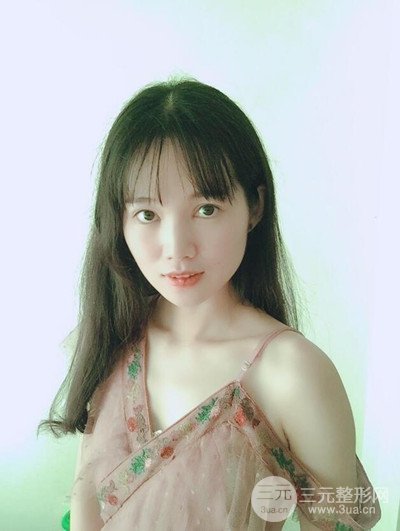 廣州晨曦切開雙眼皮恢復(fù)日記分享，附上前后對比圖