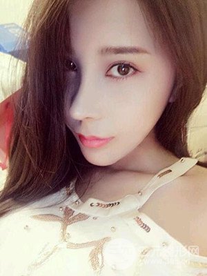 成都美萊牛永敢自體肋軟骨隆鼻案例，前后對比圖分享~