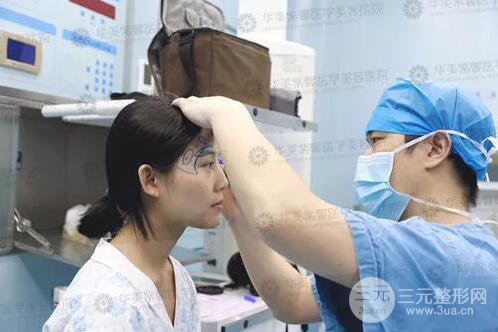 四川華美紫馨自體脂肪面部案例術(shù)后恢復(fù)日記