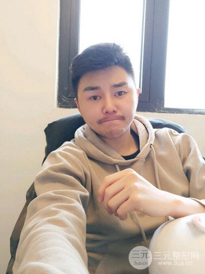 成都玉之光黃開亮醫(yī)生隆鼻修復整形案例，前后恢復過程分享