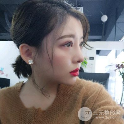 北京協(xié)和劉志飛隆鼻修復(fù)案例恢復(fù)過(guò)程日記分享