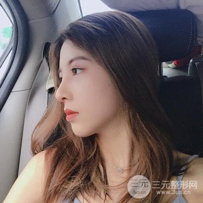 廣州藝美隆鼻日記分享！前后對(duì)比圖奉上！