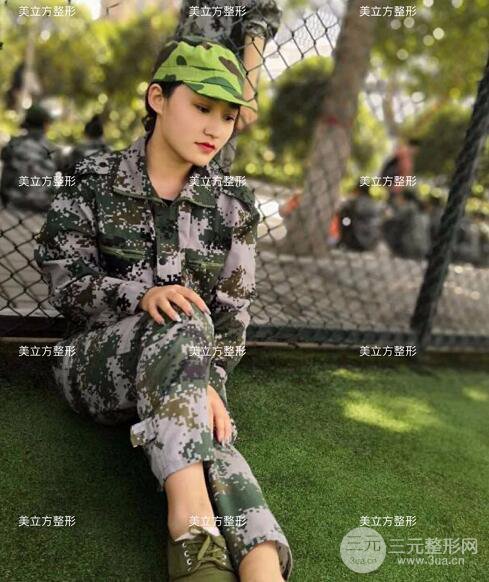 西安美立方李蓉華割雙眼皮案例術(shù)后恢復(fù)日記