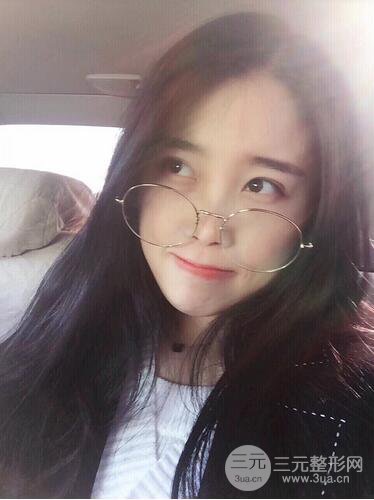 杭州藝之花楊海波整形醫(yī)生雙眼皮案例恢復(fù)日記