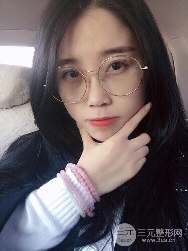 杭州藝之花楊海波整形醫(yī)生雙眼皮案例恢復(fù)日記