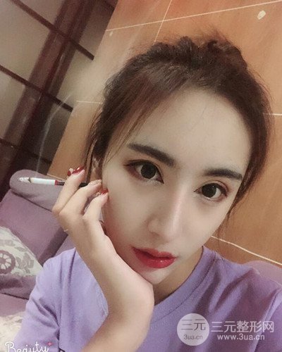 硅膠隆鼻假體取出隆鼻修復(fù)手術(shù)恢復(fù)過程分享