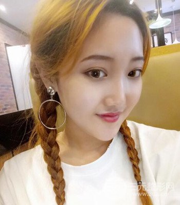 終于做了下頜角整形，分享術(shù)后恢復(fù)果