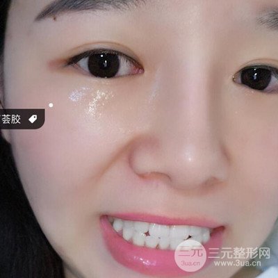 做了牙齒冷光美白果很棒，綻放美麗笑容