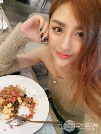 重慶鉑生王振榮隆鼻整形前后對(duì)比圖恢復(fù)過(guò)程分享