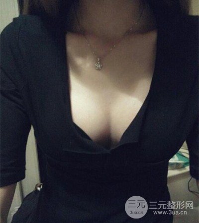 平胸妹做了假體隆胸果分享，豐滿身材不是夢(mèng)